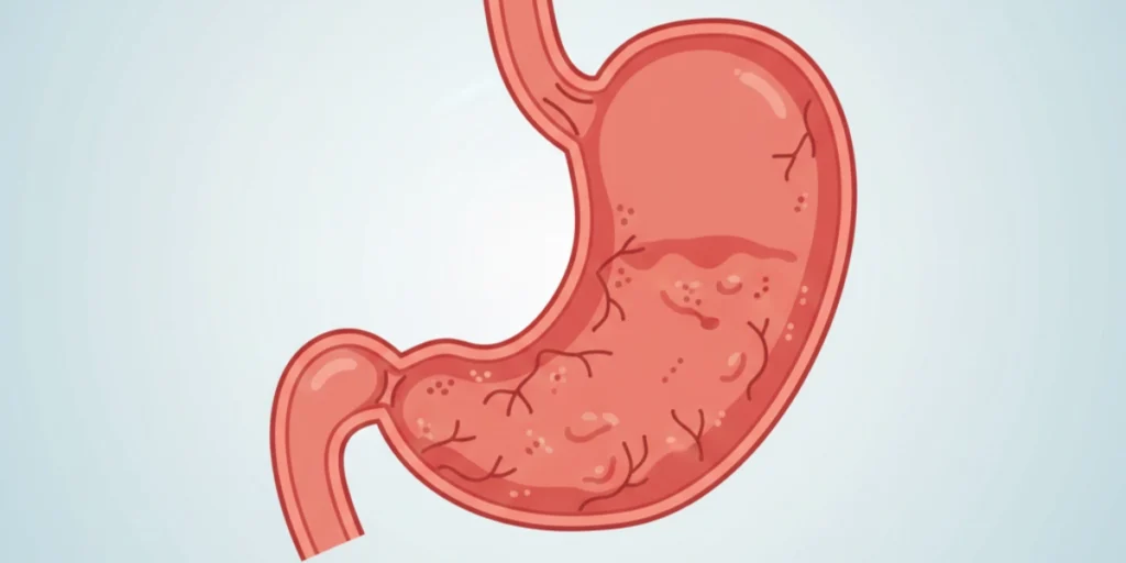 Illustration showing how alcohol affects the stomach and digestion.